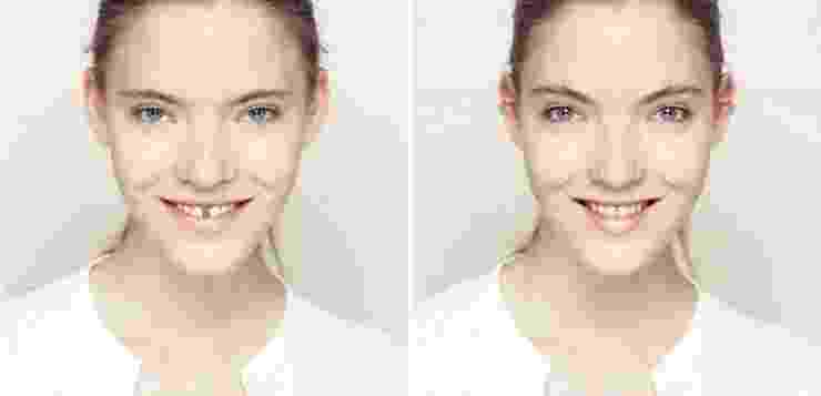 Как выглядели бы лица людей, если были бы абсолютно симметричными