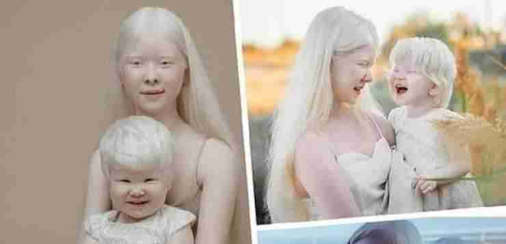Сестры альбиносы из Казахстана