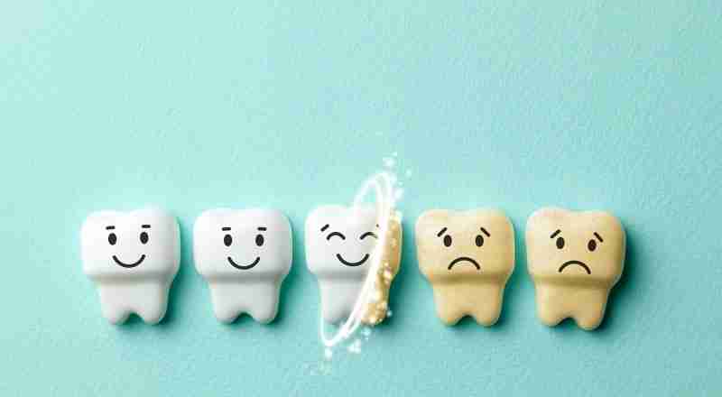 Как безопасно поддерживать здоровье зубов в домашних условиях: лайфхаки от стоматолога